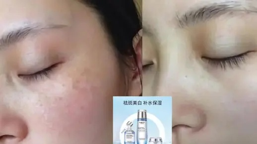 揭秘淡斑效果显著的化妆品品牌