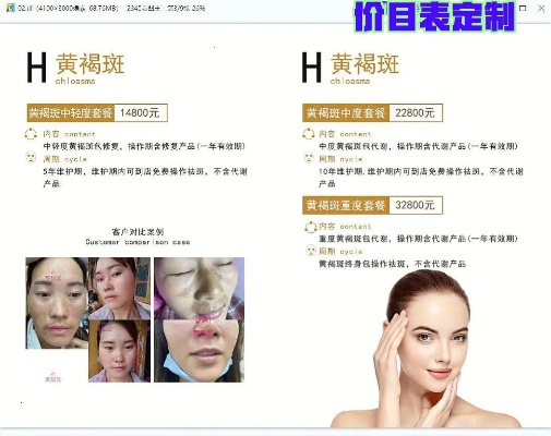 新昌祛痘加盟收费详解，了解费用结构，开启美丽事业