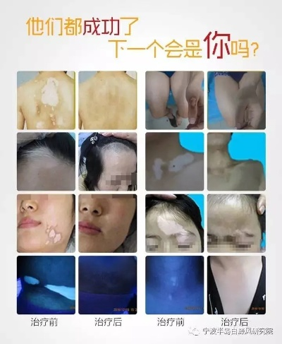 白条买什么套出来最快？深度解析快速套现攻略