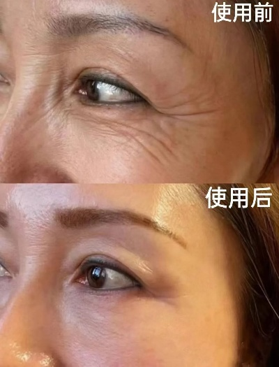 揭秘，哪些品牌化妆品有效减少皱纹