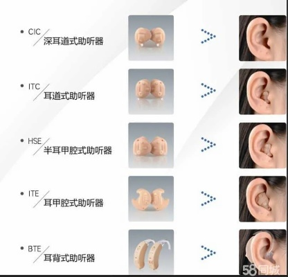 禹州助听器品牌厂家电话及案例解析