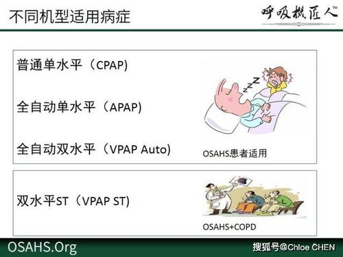 羊小咩便荔卡套出来客户去哪找？揭秘客户寻找攻略！
