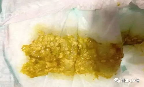 揭秘羊小咩便荔卡套，真的可信吗？