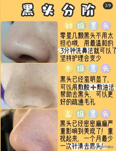 祛黑头推荐医药品牌