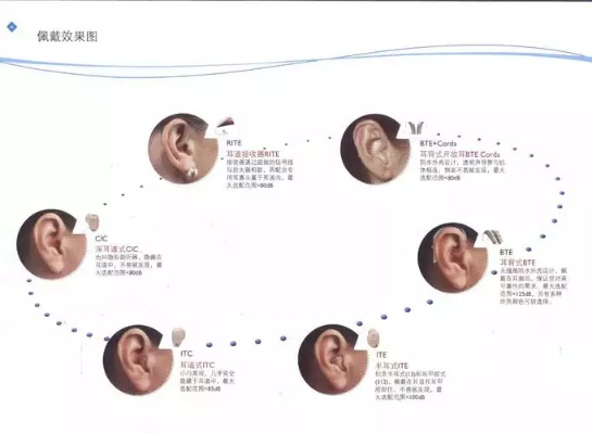 鹤壁助听器品牌厂家电话与案例解析