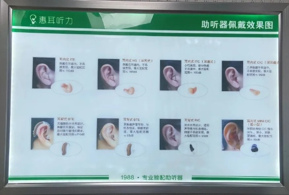韶关品牌助听器厂家电话与案例解析